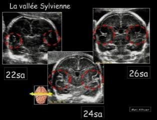 La gyration : ce que vous pouvez voir tous les jours