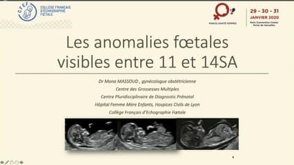 Les anomalies visibles entre 11 et 14SA