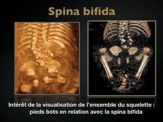imagerie volumique et multiplanaire squelettique (US et TDM)