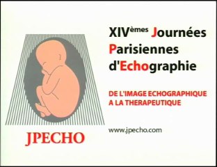 Synthèse, dépistage, EPP : les secrets d’un mariage heureux