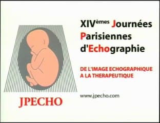 Synthèse, dépistage, EPP : les secrets d’un mariage heureux