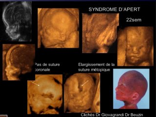 Les anomalies de la face