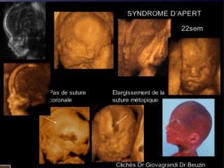 Les anomalies de la face