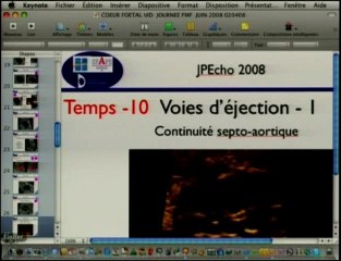 Dépistages des anomalies cardiaques