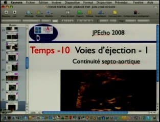 Dépistages des anomalies cardiaques