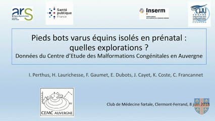53 Pieds Varus Equins isolés en prénatal : quelles explorations ? Données du registre des malformations Auvergne