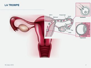 Hystérosonographie interventionnelle (hysterosalpingo-contrast-sonography, HyCoSy) : indications actuelles.