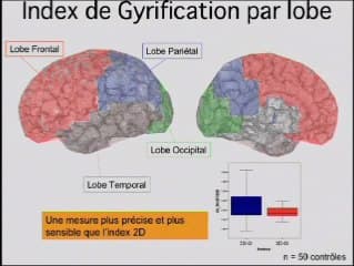 Anomalies de la gyration et du développement cérébral chez les patients atteints de microdélétion 22q11