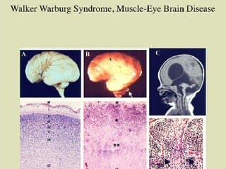 Qu'attendre de l'analyse morphologique au 1er trimestre ?(tarduit)