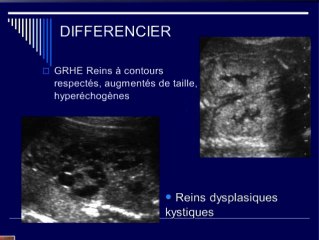 Reins échogènes