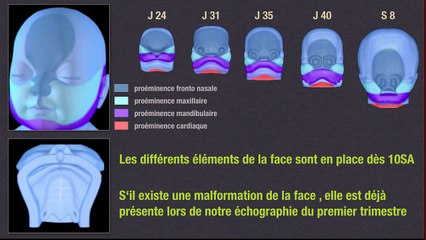 Des recommandations du CTN à la suspicion d’anomalie d’organe au 1er trimestre. Gérer la chaîne diagnostique :Face.