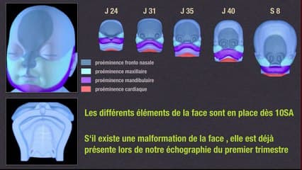 Des recommandations du CTN à la suspicion d’anomalie d’organe au 1er trimestre. Gérer la chaîne diagnostique :Face.