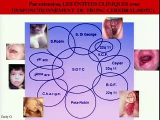 La qualité de l’oralité, avenir de l’échographie faciale.neurofonctionnalité de l'oralité
