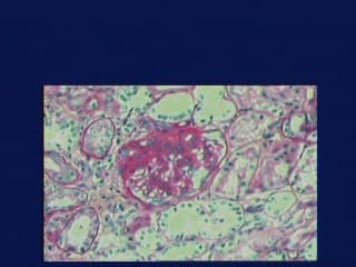 L’échographie peut-elle contribuer au diagnostic des syndromes néphrotiques congénitaux ?