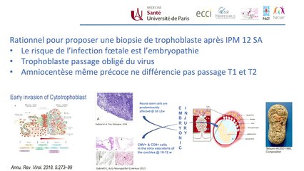 CMV - Bilan récent