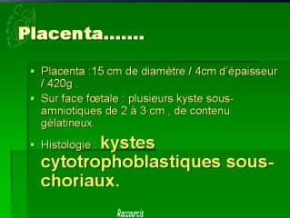 Fibrosarcome de la cuisse, kystes cytotrophoblastiques sous-choriaux
