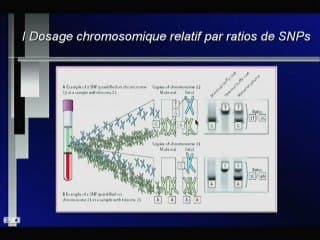 Dépistage de la T21 Diagnostic de T21 sur sang maternel