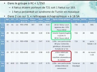 Risque combiné du 1er trimestre et clarté nucale supérieure au 95ème centile : Etude BioNuQual