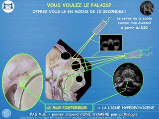 POSTER Palais