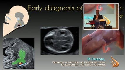 1er Trimestre Clarté intra-cérébrale : 10 ans après