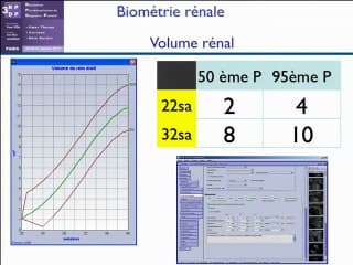 Formation de la vessie et des voies urinaires