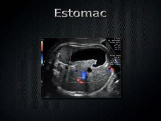 L'imagerie ultrasonore foetale