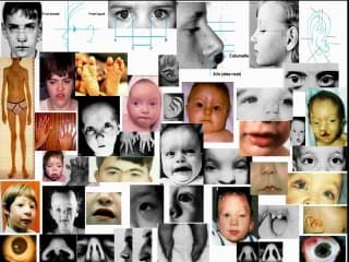 De la genetique au coeur