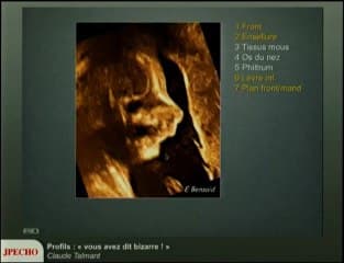 Profils : « vous avez dit bizarre ! »