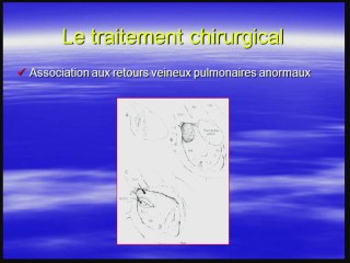 anatomie chirurgicale du coeur
