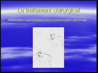 anatomie chirurgicale du coeur