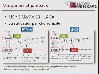 Le dépistage des aneuploïdies dans les grossesses gémellaires où en est-on ?