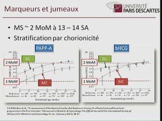Le dépistage des aneuploïdies dans les grossesses gémellaires où en est-on ?