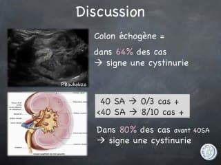 Colon hyperéchogène
