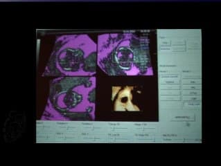 Une nouvelle technique : le moulage 3D