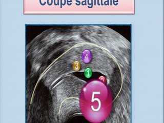 Quiz ? image : qu'est-ce que c'est ? Échographie 2D/3D, échosonographie