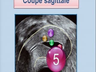 Quiz ? image : qu'est-ce que c'est ? Échographie 2D/3D, échosonographie