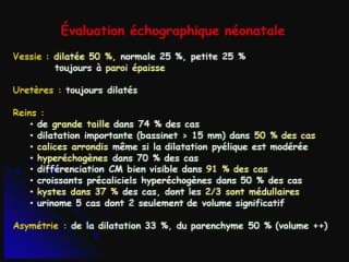 Valve de  l'urèthre postérieur : - Evaluation néonatale.