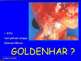 Echographie du 1er trimestre, jusqu'ou peut on aller : Enquête de la SOFFOET sur les IMG du 1er trimestre 1/2