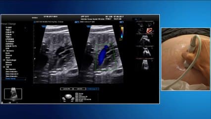 Recommandations CNEOF 2016 : les inchangés et les nouveautés. Coeur Live en parallele : comment examiner le coeur