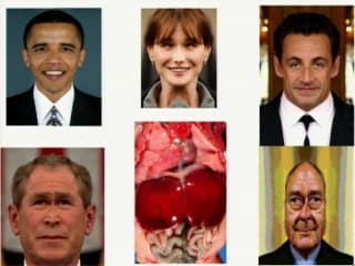 Génétique, biologie du développement. Application pratique : late_ralite_ et grossesse ge_mellaire monochoriale