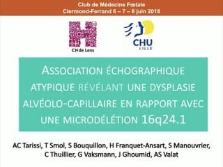 15  Association échographique atypique révélant une dysplasie alvéolo-capillaire en rapport avec une microdélétion 16q24.1