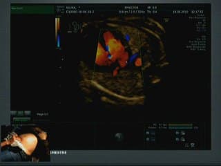 Live cœur 3ème trimestre