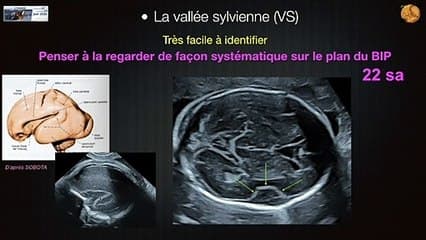 SYSTÈME NERVEUX CENTRAL Giration