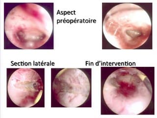 Quiz ? image : qu'est-ce que c'est ? IRM, hystéroscopie