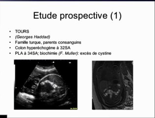 Colon hyperéchogène