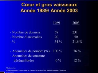 Quand demander un caryotype foetal devant un signe échographique au 2eme trimestre ? Malformations cardiovasculaires,de parois, digestives