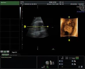 demo live abdomen  ( en ANGLAIS )