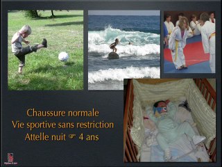 PRiSE EN CHaRGE DES PiEDS bOtS La me_thode de Ponseti
