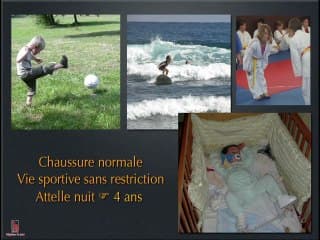 PRiSE EN CHaRGE DES PiEDS bOtS La me_thode de Ponseti