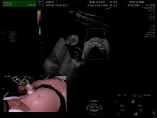 Démonstration live : la face aux trois trimestres. Tout ce que l’on peut voir, tout ce que l’on doit voir.